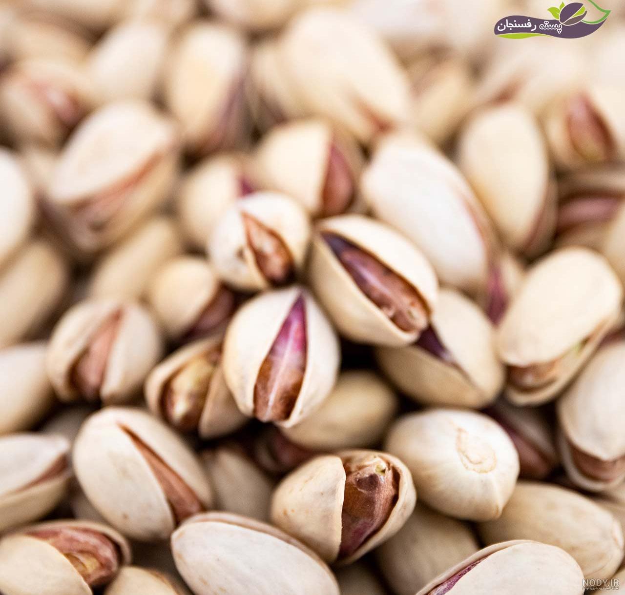 تفاوت درخت پسته اکبری و احمدآقایی تفاوت درخت پسته اکبری و احمدآقایی