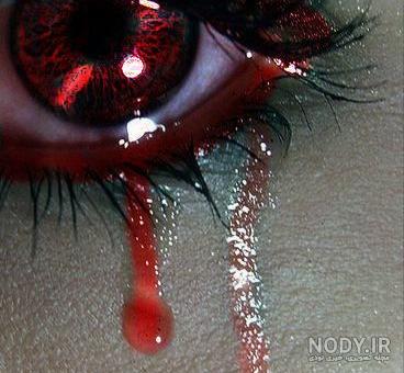عکس گریه چشم خونی عکس گریه چشم خونی