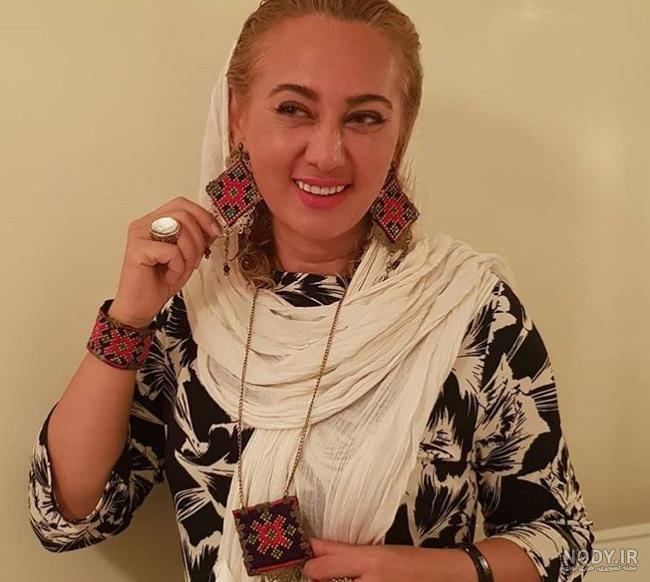 بیماری تبسم هاشمی بیماری تبسم هاشمی