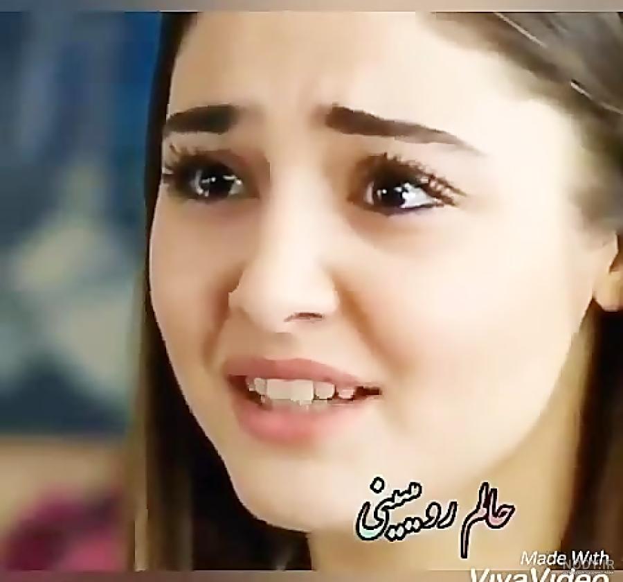 عکس هانده ارچل قبل از عمل
