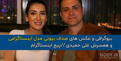 قبل عمل صدف بیوتی قبل عمل صدف بیوتی