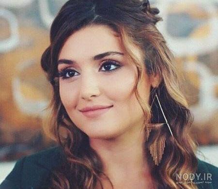 هانده ارچل بعد از عمل فک