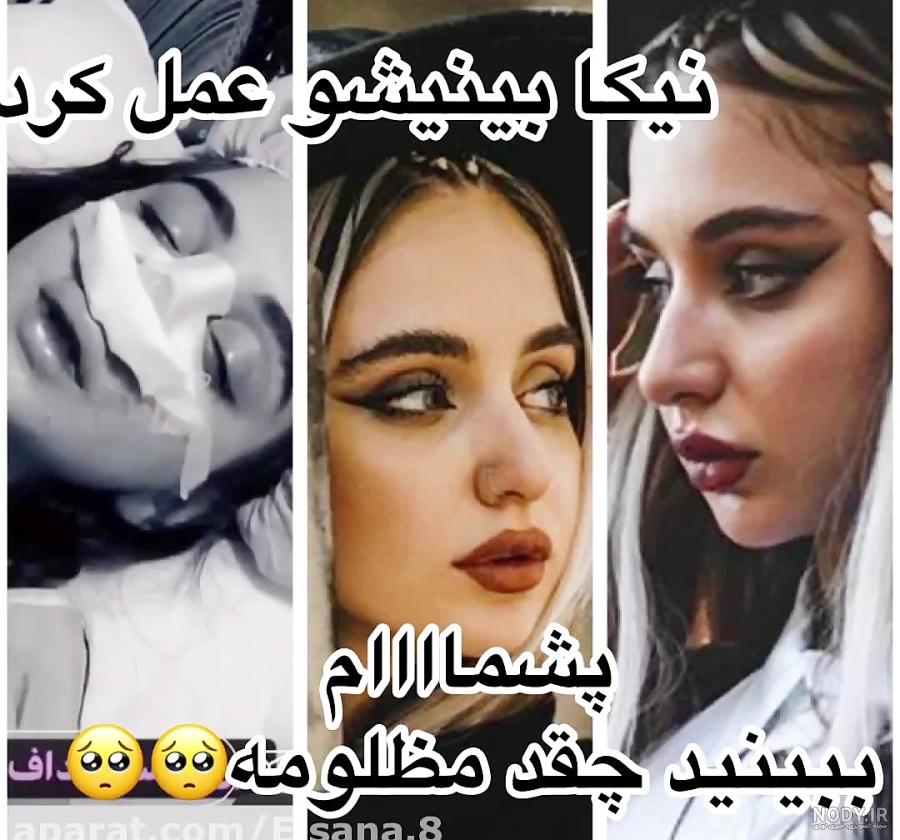 عکس قبل از عمل نیکا فلاحی