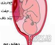 لکه بینی در بارداری نشانه پسر