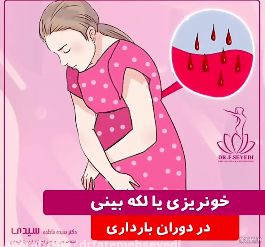 لکه بینی و کمردرد در اوایل بارداری