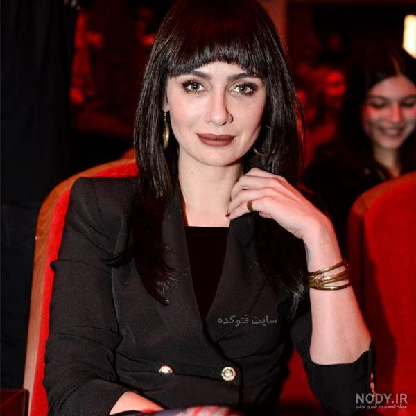 بیرجه آکالای قبل از عمل