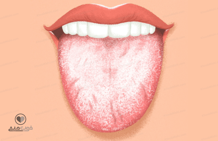 تشخیص بیماری از رنگ زبان