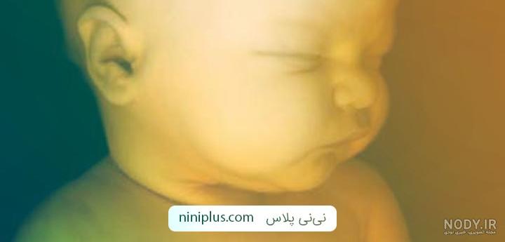 سونوگرافی جنین دختر نی نی سایت سونوگرافی جنین دختر نی نی سایت
