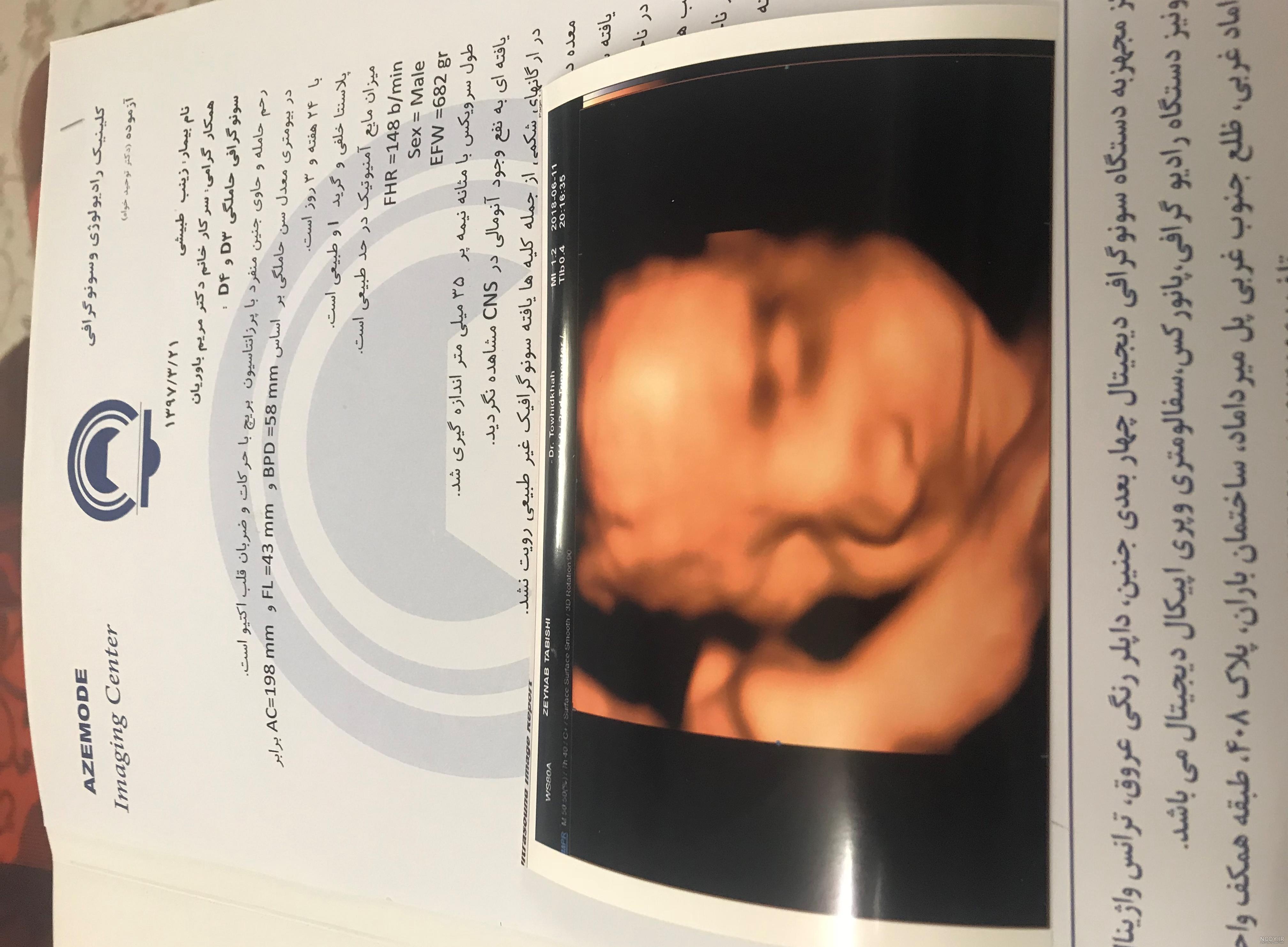 عکس سه بعدی جنین نی نی سایت