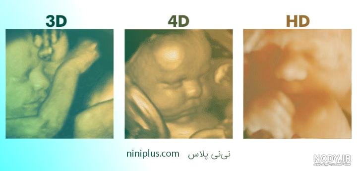 چهره نوزاد نی نی سایت چهره نوزاد نی نی سایت