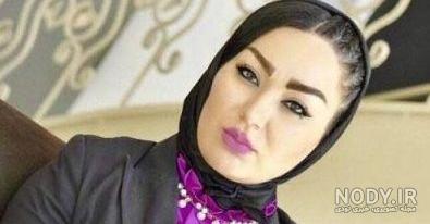 شقایق دلشاد در شهرزاد