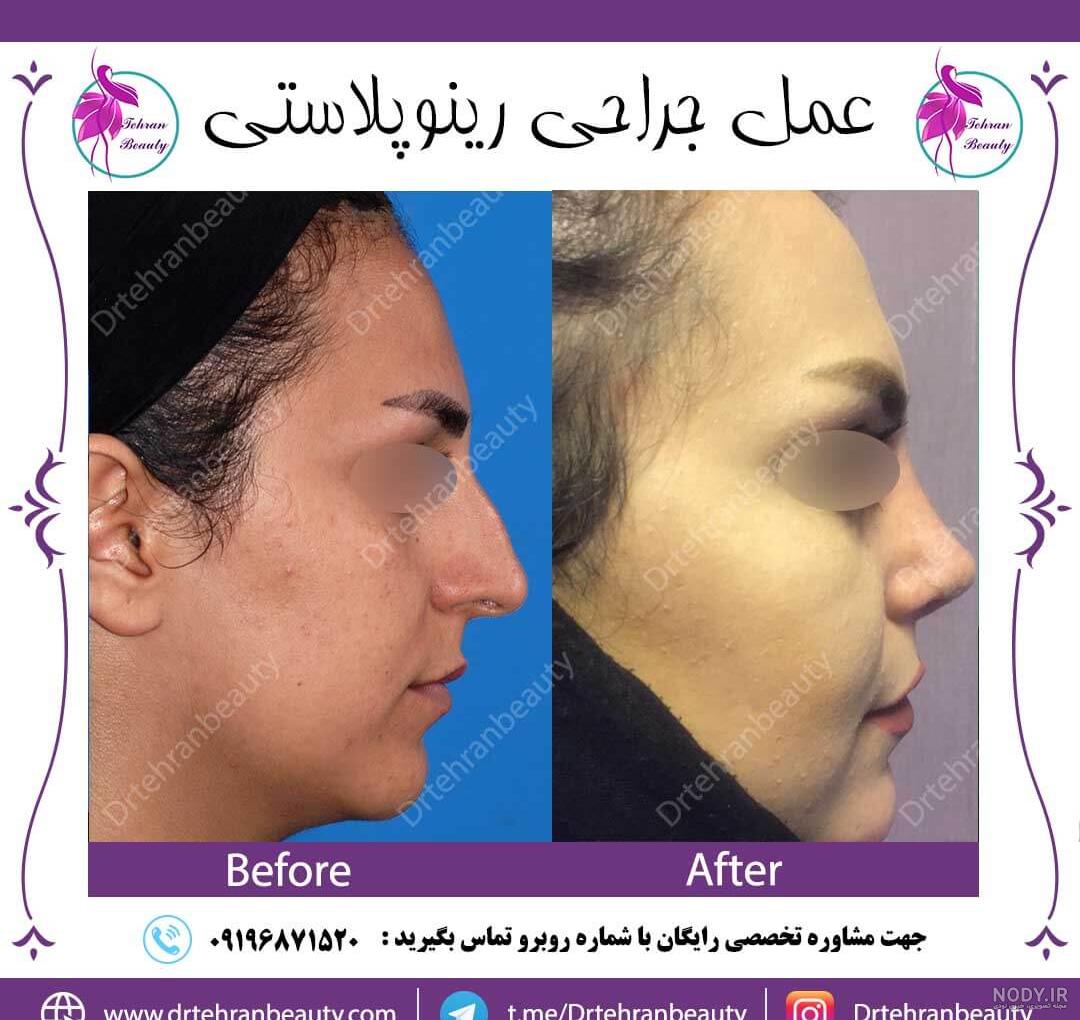 عکس رادیولوژی برای عمل بینی
