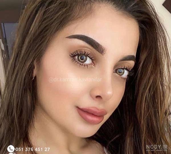 عکس قبل عمل بینی
