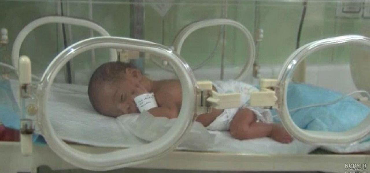 عکس نوزاد 28 هفته