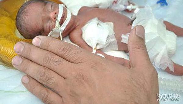 عکس نوزاد نارس هشت ماهه