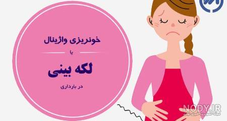 لکه بینی در بارداری نشانه پسر