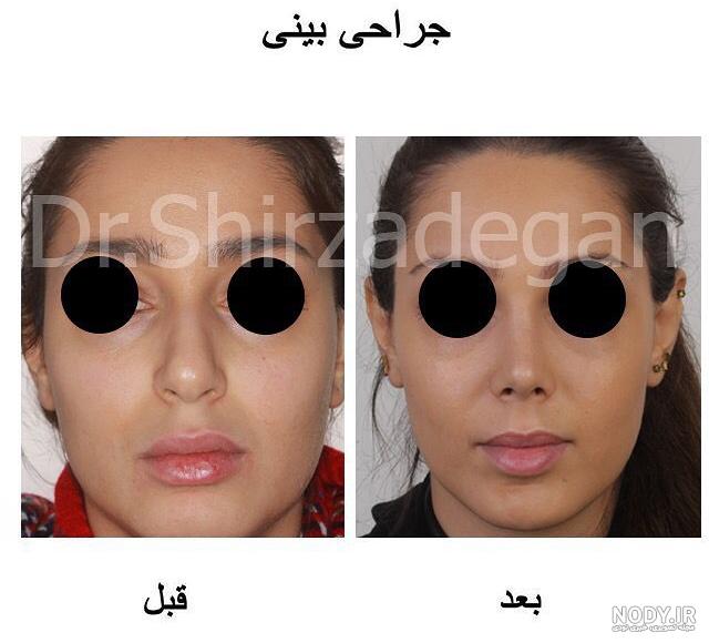 هزینه فتوگرافی بینی نی نی سایت