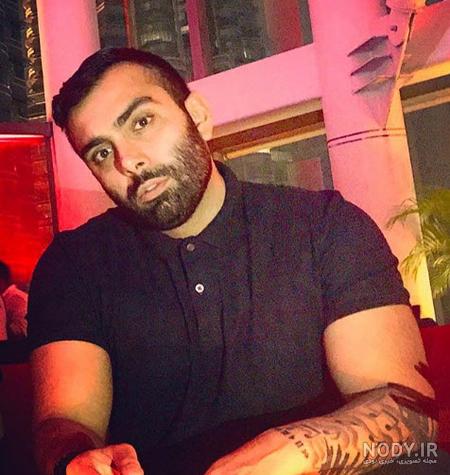 مسعود صادقلو قبل از عمل بینی مسعود صادقلو قبل از عمل بینی