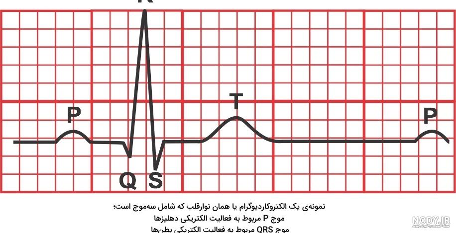ضربان قلب غیر نرمال