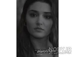 عکس هانده ارچل زیبا