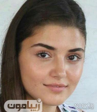 عکس های هانده ارچل قبل عمل زیبایی عکس های هانده ارچل قبل عمل زیبایی