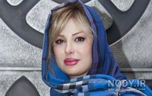 نیوشا ضیغمی قبل از عمل