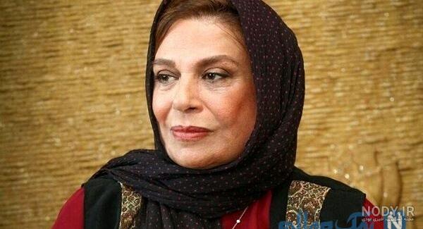 عاطفه رضوی قبل از عمل عاطفه رضوی قبل از عمل
