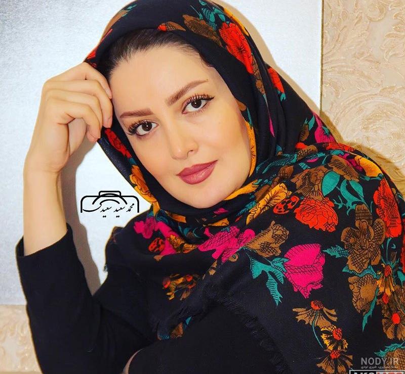 شیلا خداداد قبل و بعد از عمل شیلا خداداد قبل و بعد از عمل
