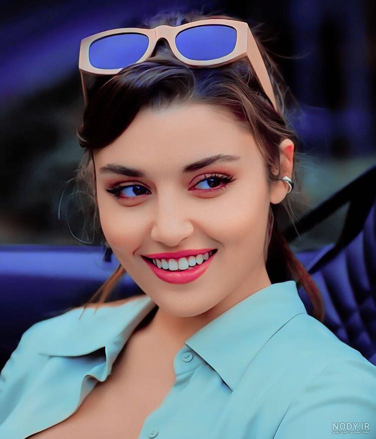 چرا هانده ارچل لاغر شده چرا هانده ارچل لاغر شده