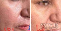 دکتر اعظم خادمی ایذه دکتر اعظم خادمی ایذه