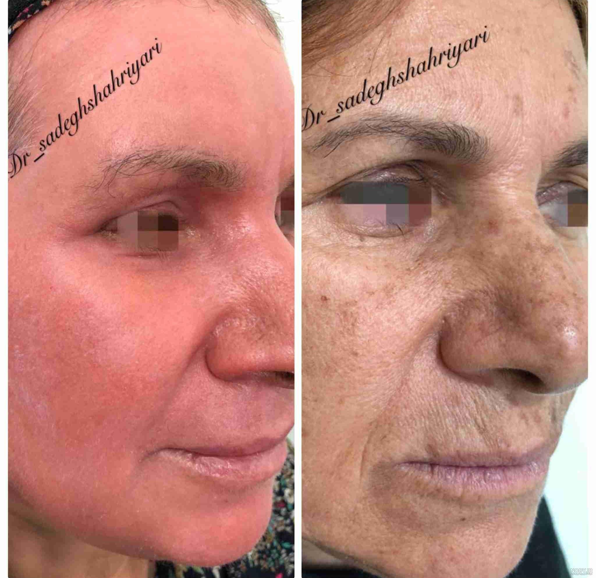 دکتر صادق شهریاری نی نی سایت دکتر صادق شهریاری نی نی سایت