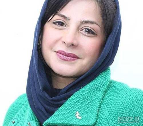 عکس هلیا امامی قبل از عمل زیبایی عکس هلیا امامی قبل از عمل زیبایی