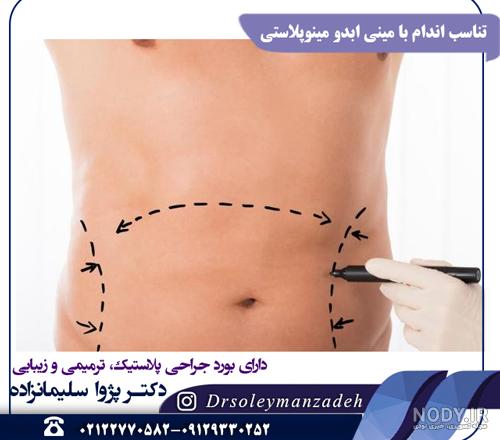 عکس مینی ابدو
