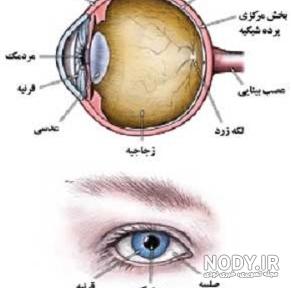 عکس چشم مبتلا به اب سیاه عکس چشم مبتلا به اب سیاه