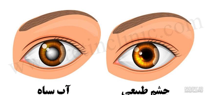 همه چیز درباره آب سیاه چشم همه چیز درباره آب سیاه چشم