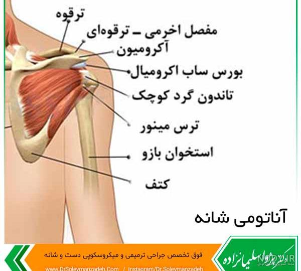 جا انداختن استخوان ترقوه