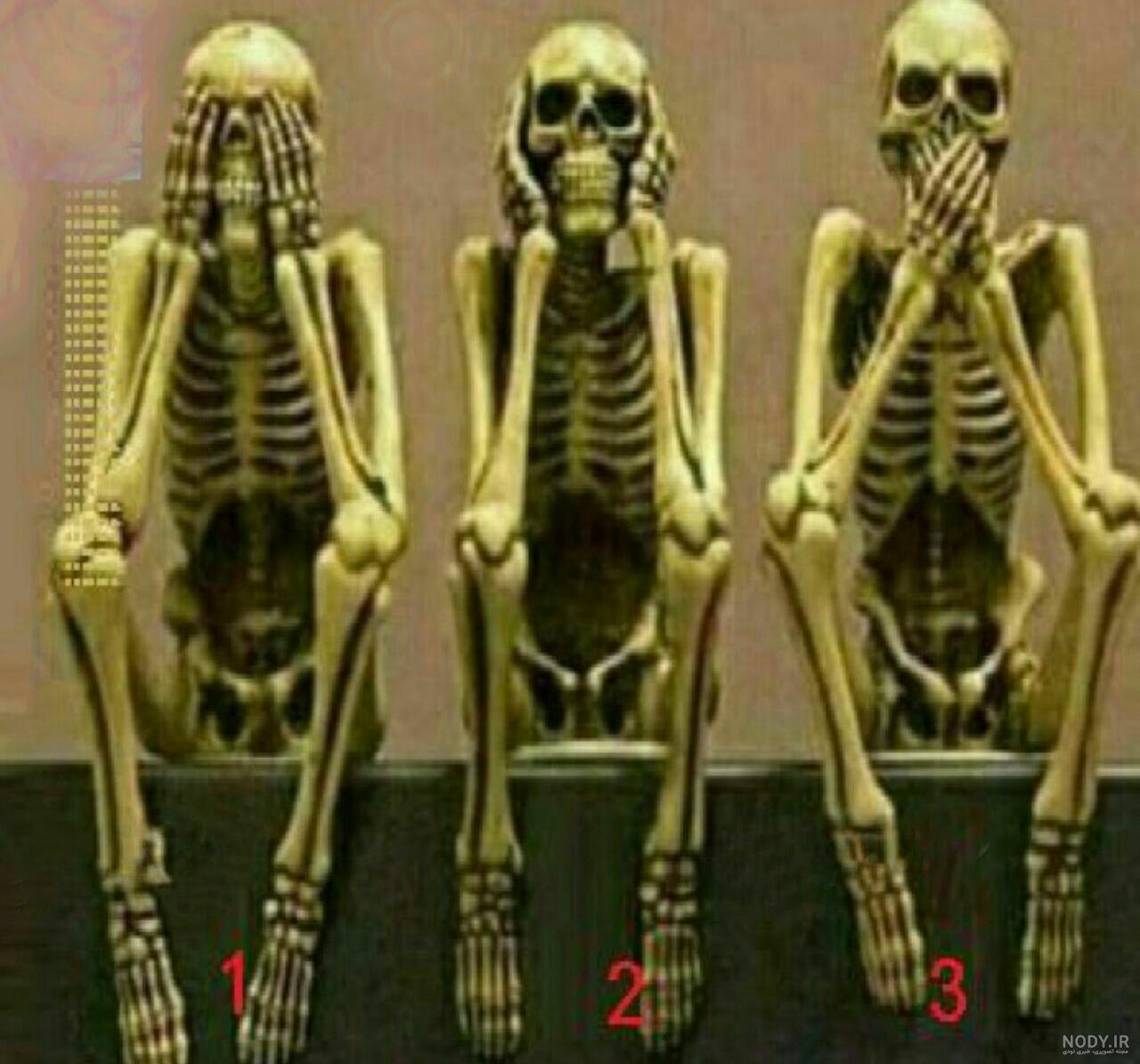 عکس از یک اسکلت