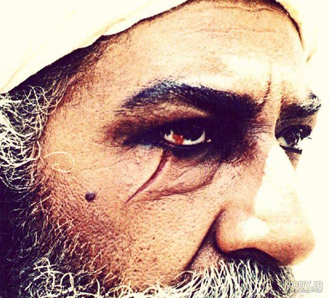 عکس زخم صورت مختار عکس زخم صورت مختار