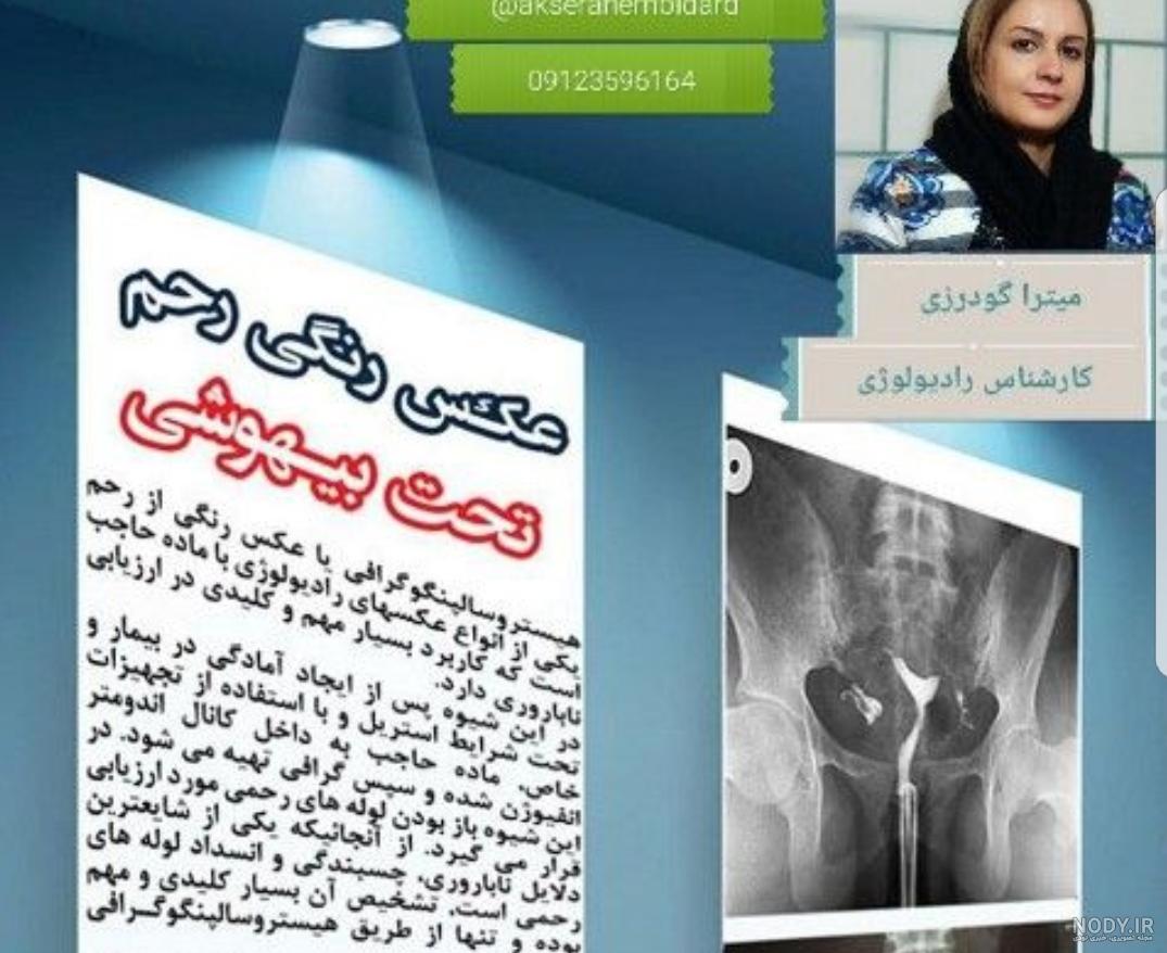مسکن قوی برای عکس رنگی رحم