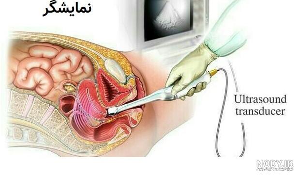 کیا عکس رنگی رحم گرفتن سال ۹۹