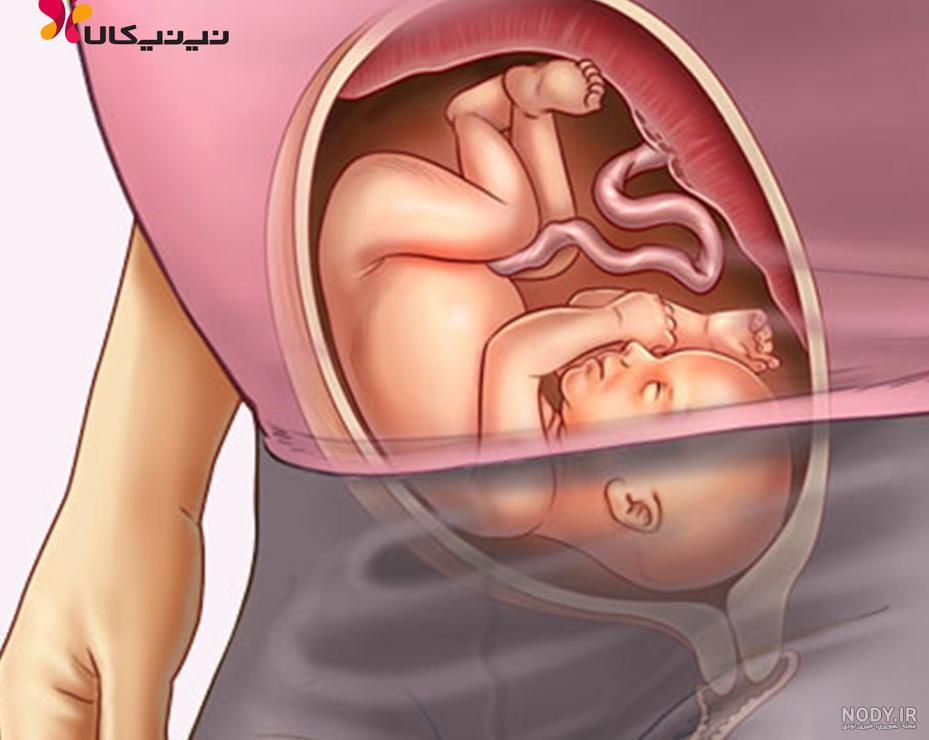 ترشح در هفته بیست و ششم بارداری ترشح در هفته بیست و ششم بارداری