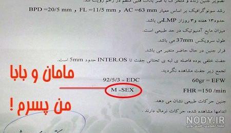 تفاوت جنین دختر و پسر در سونوگرافی هفته 12 نی نی سایت