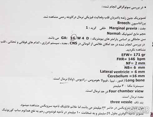 علامت اختصاری جنین پسر در سونوگرافی