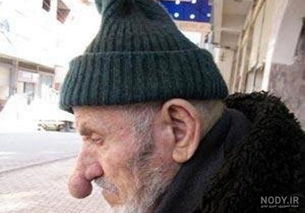 عکس اپل خنده دار عکس اپل خنده دار