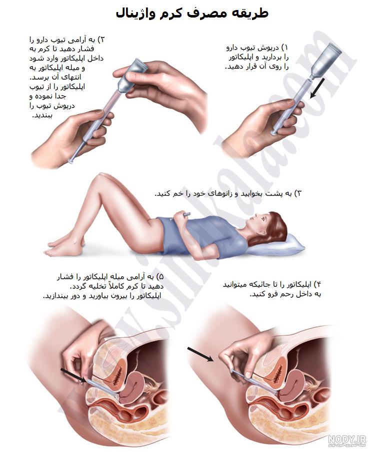 عکس اپلیکاتور عکس اپلیکاتور