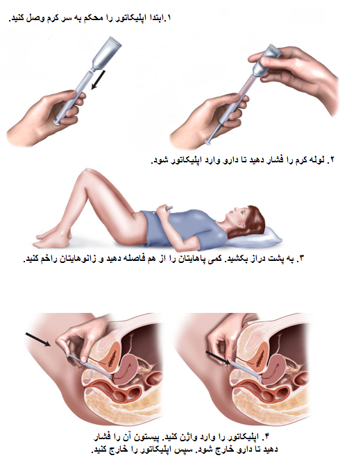 عکس اپلیکاتور لنز عکس اپلیکاتور لنز