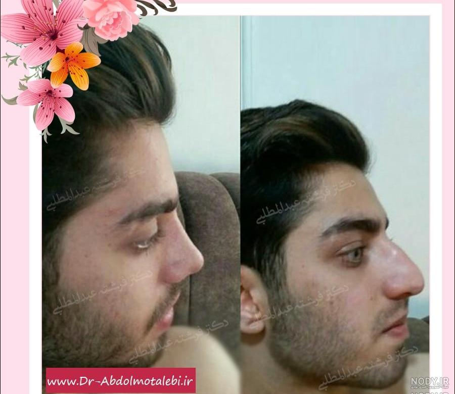 عکس پسر دماغ عملی خوشگل