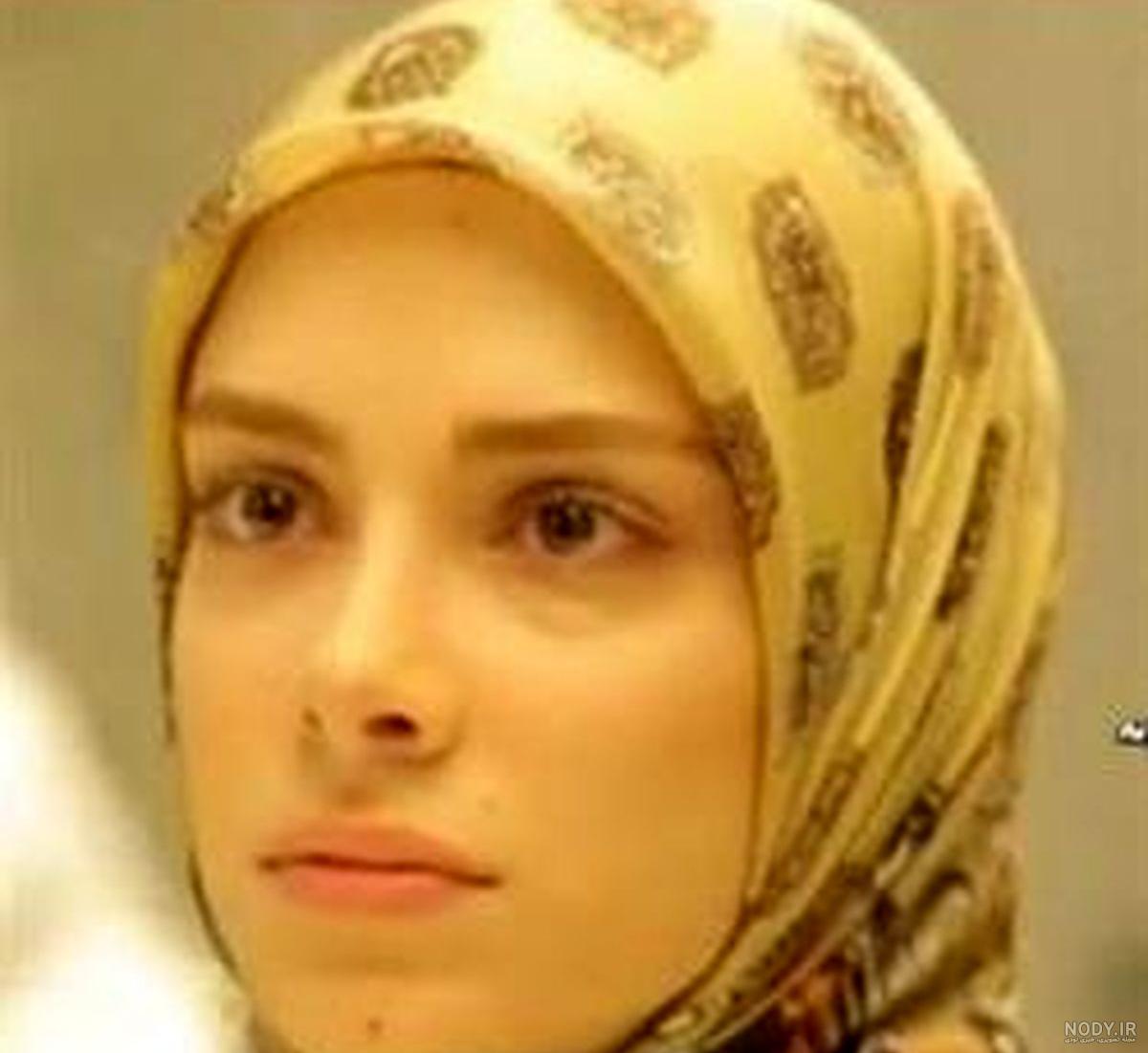 بیماری صبا راد