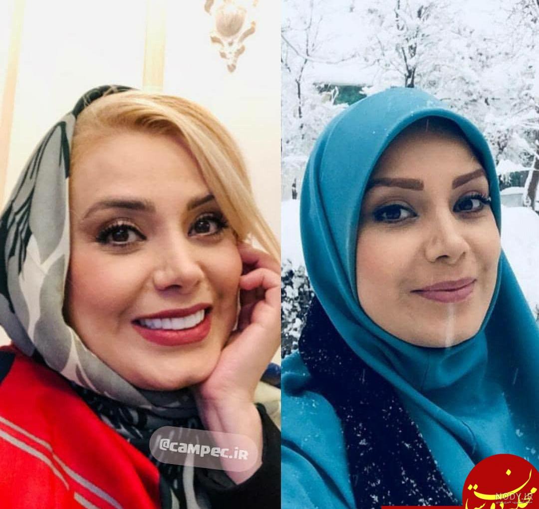 بیماری صبا راد.
