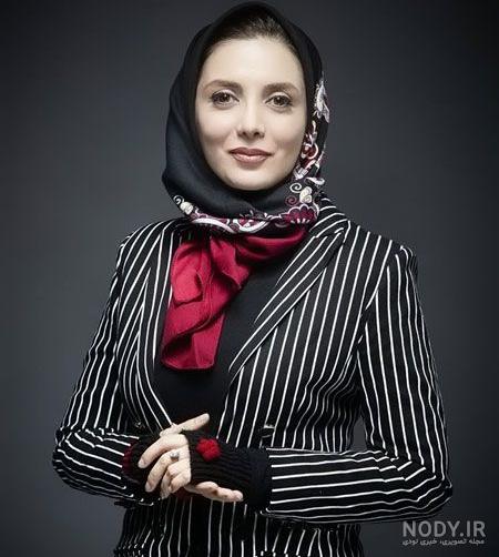 رویا میرعلمی قبل از عمل زیبایی